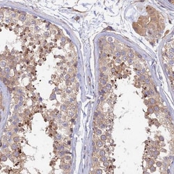 Myosin IXA Antibody, Novus Biologicals 0.1 mL | Buy Online | Novus Biologicals | Fisher Scientific
